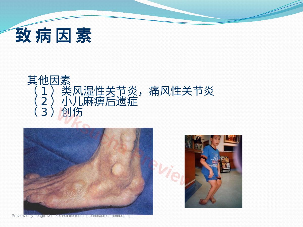 预览第 13 页