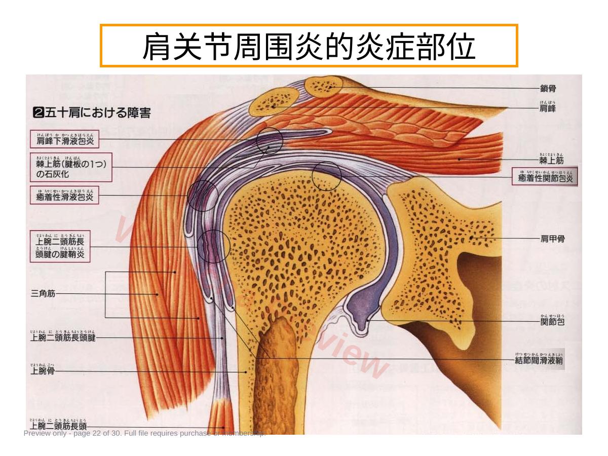 预览第 22 页