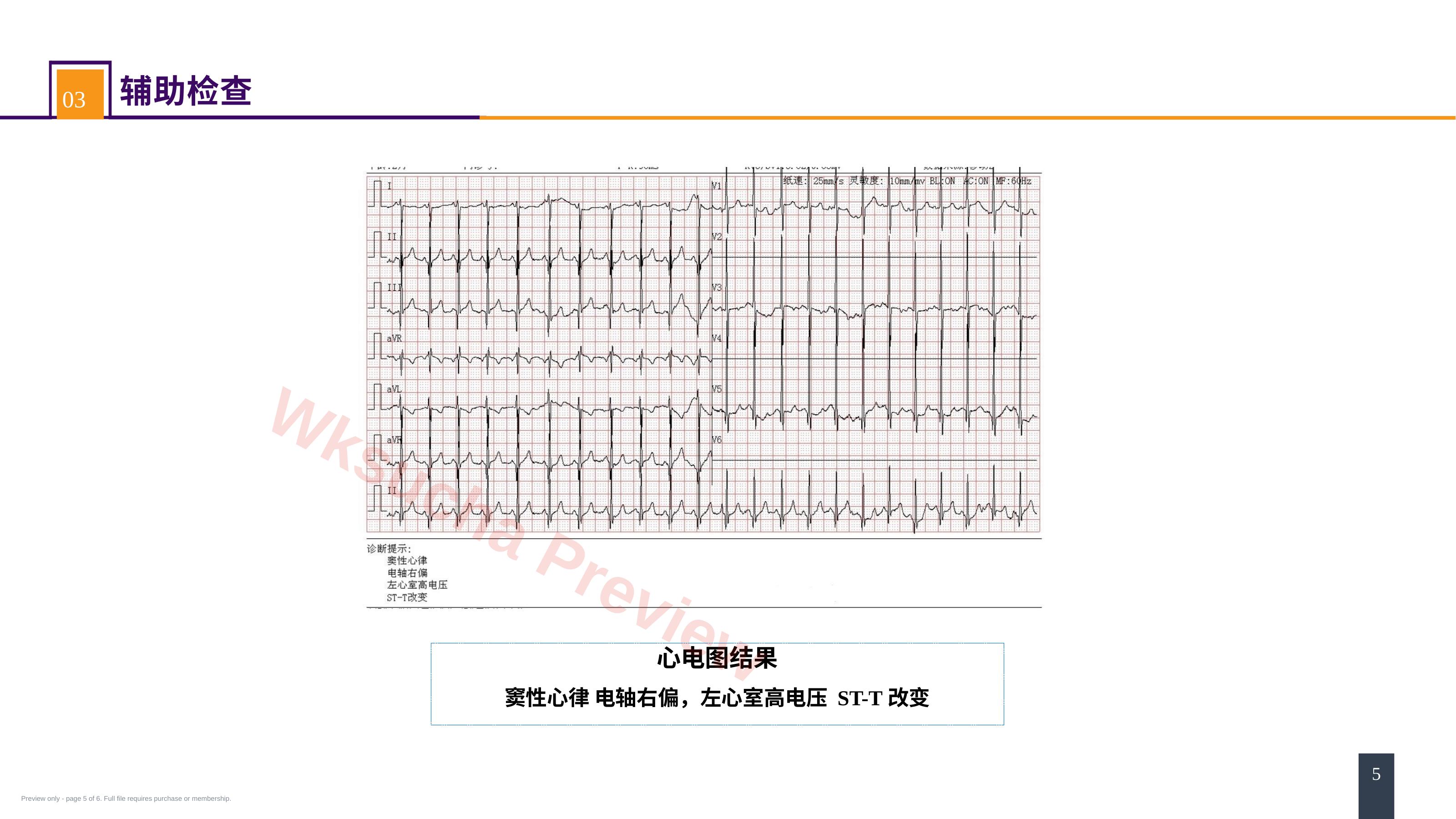 预览第 5 页