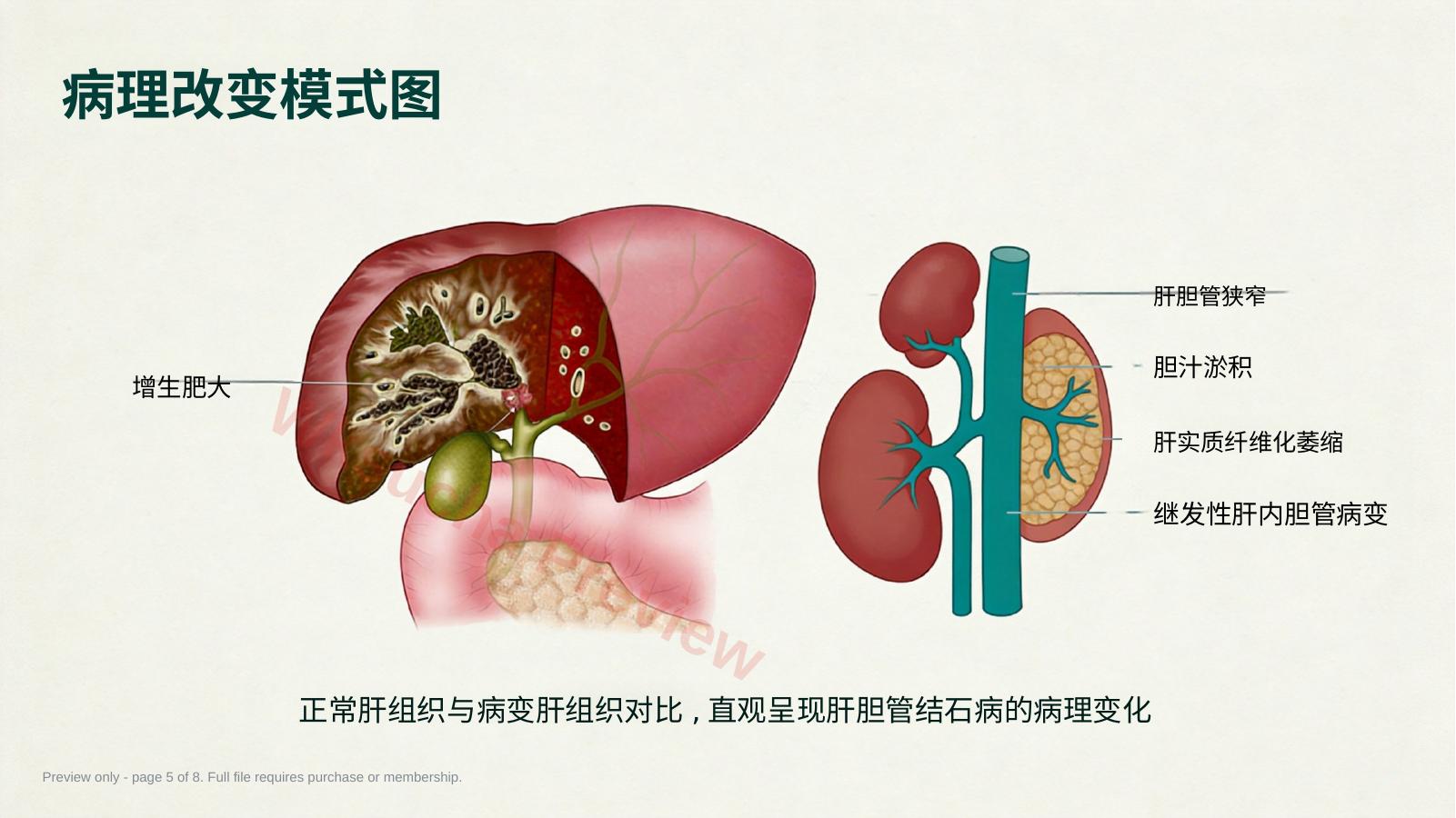 预览第 5 页