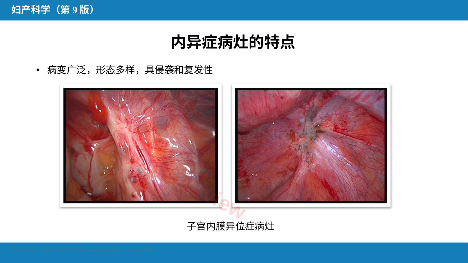 预览第 14 页