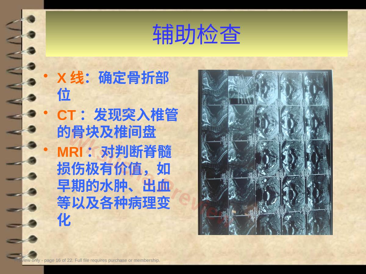 预览第 16 页