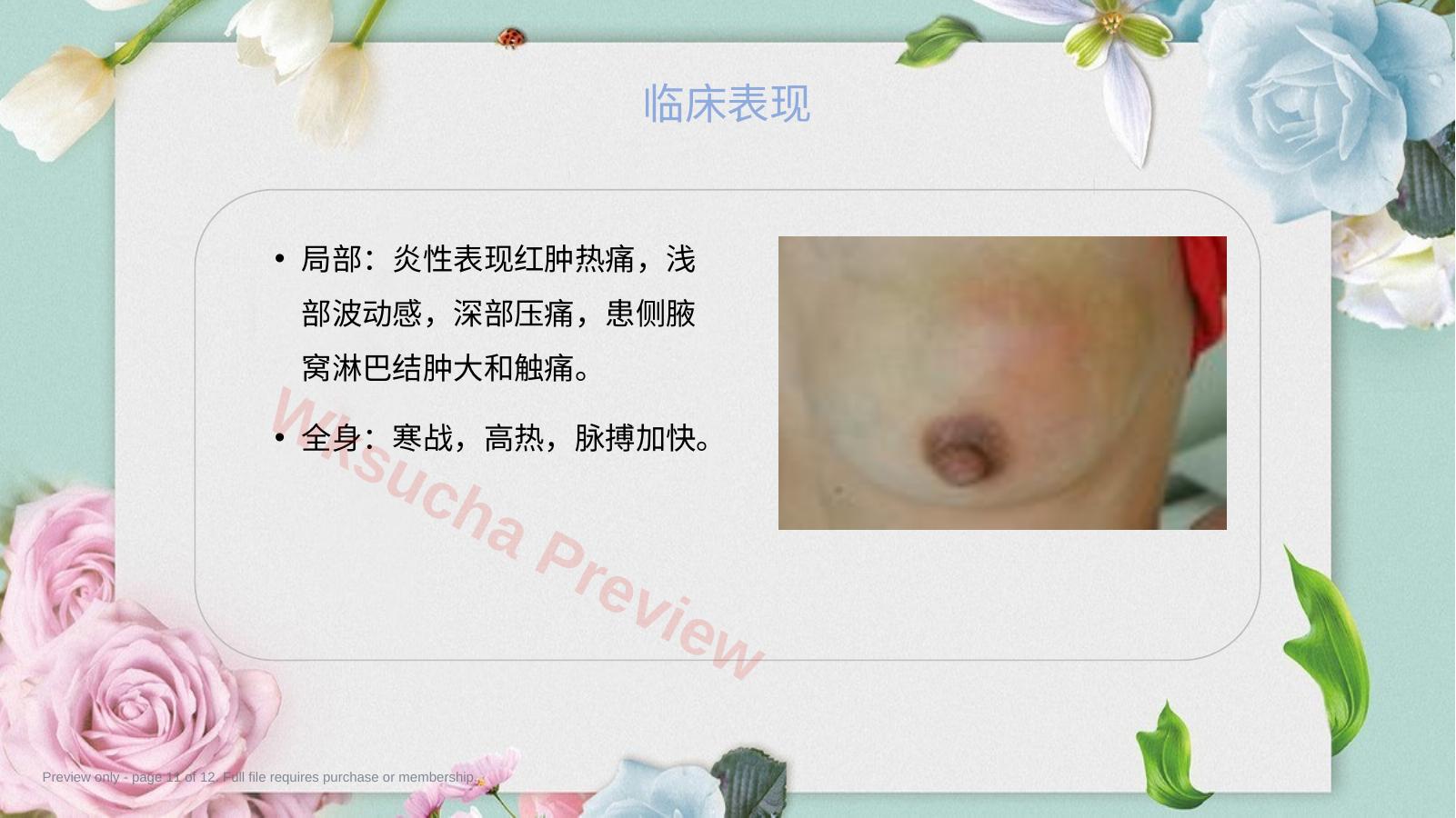 预览第 11 页