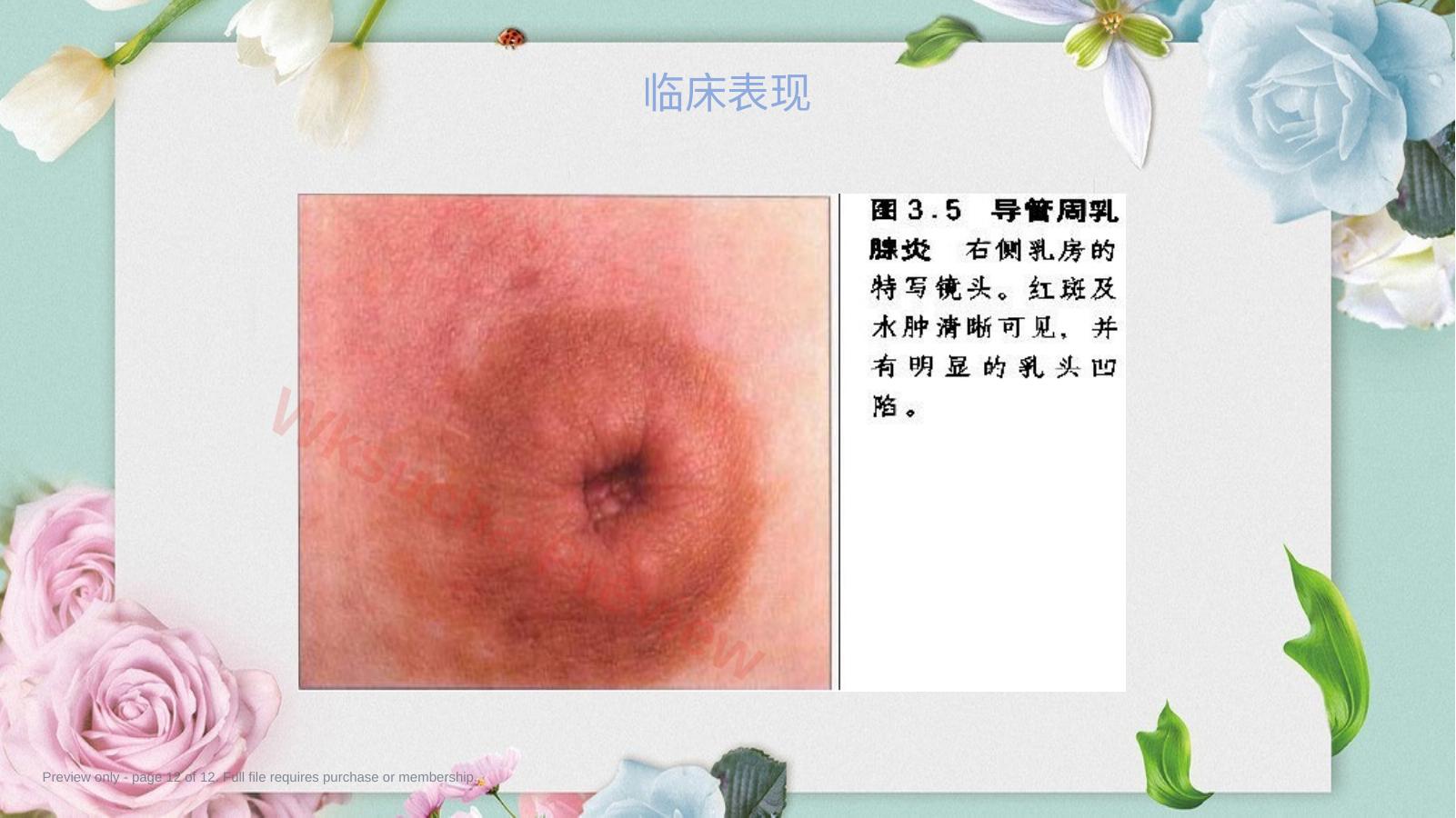 预览第 12 页