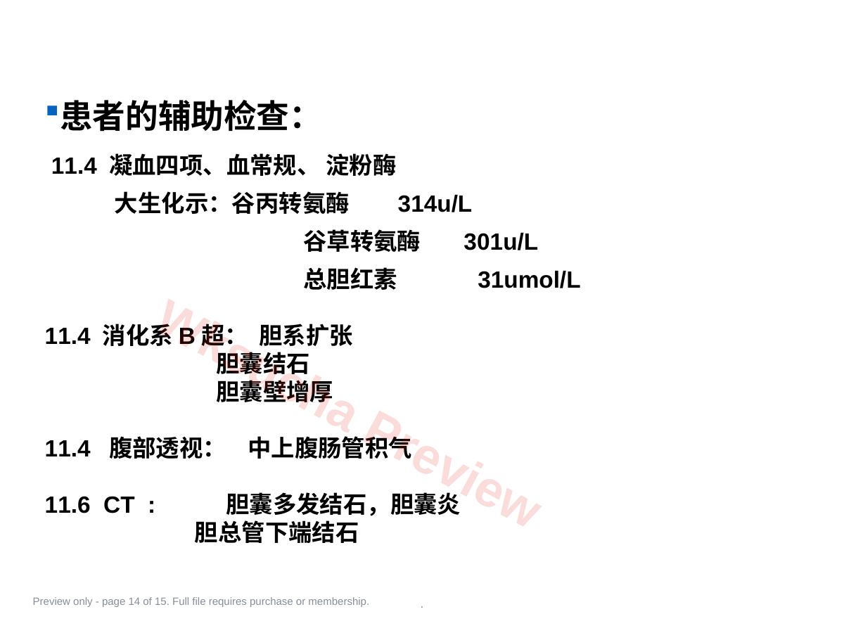预览第 14 页