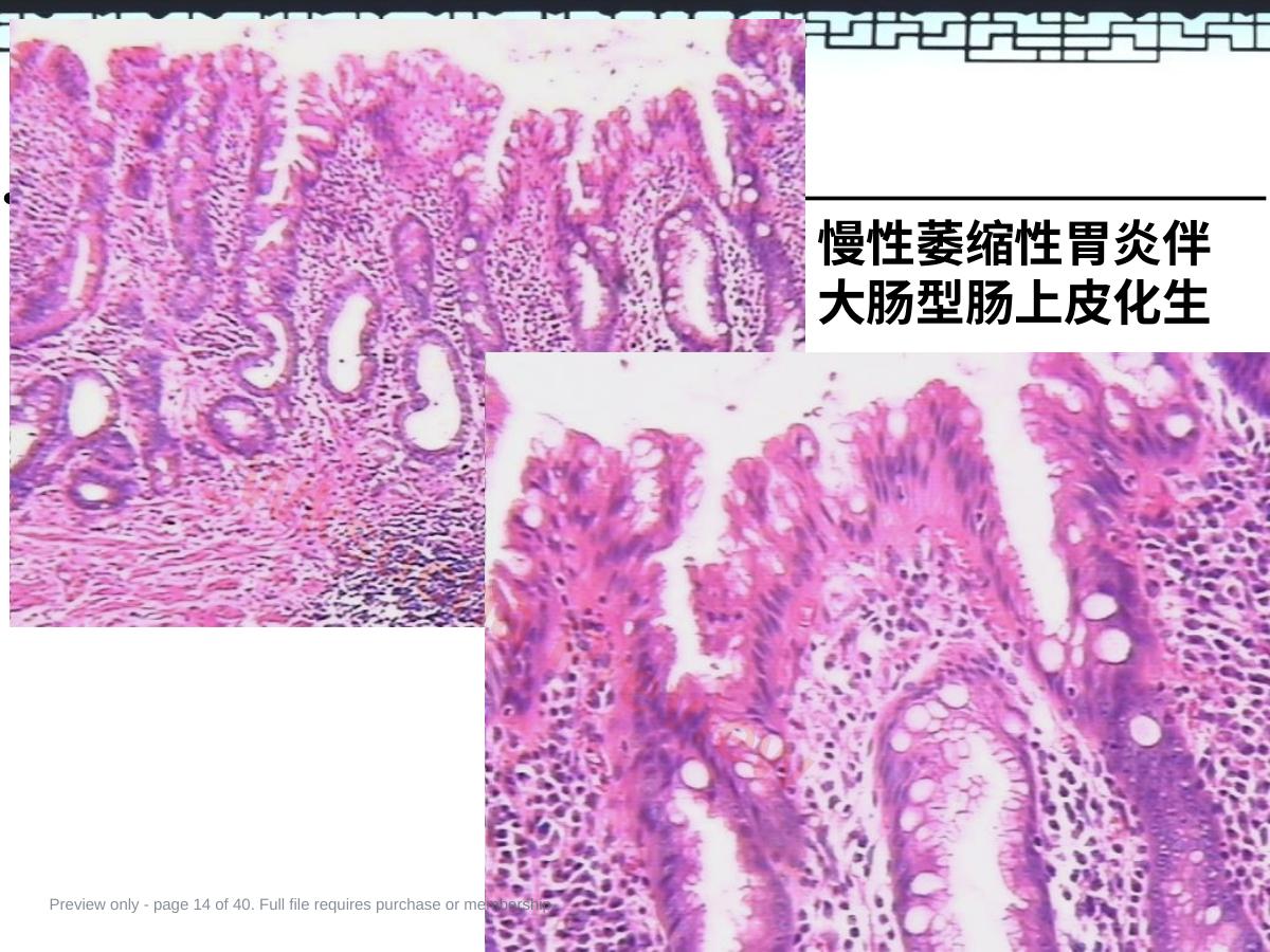 预览第 14 页