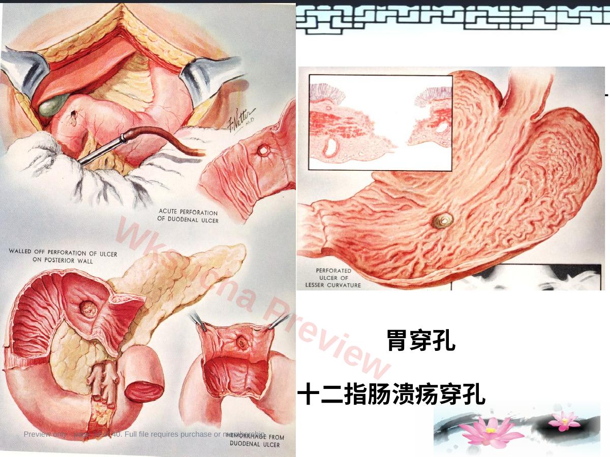 预览第 34 页