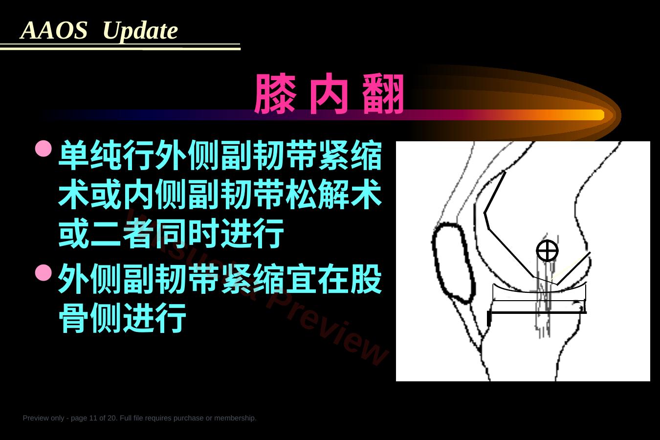 预览第 11 页