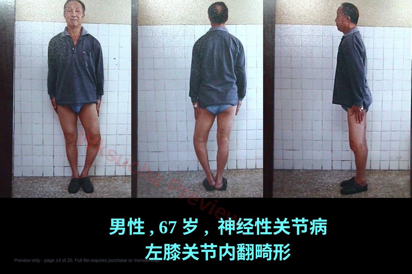 预览第 14 页