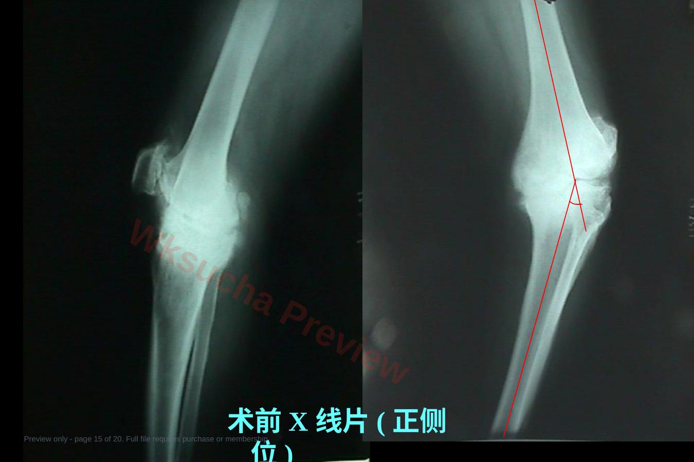 预览第 15 页