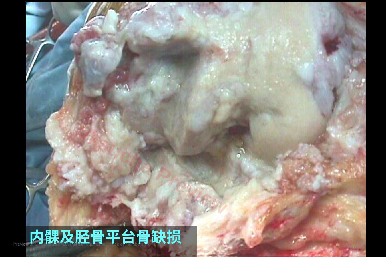 预览第 16 页