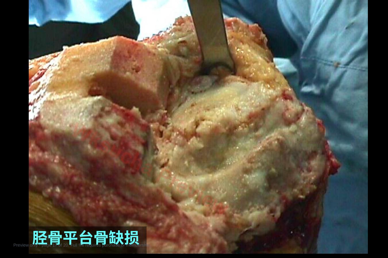 预览第 17 页