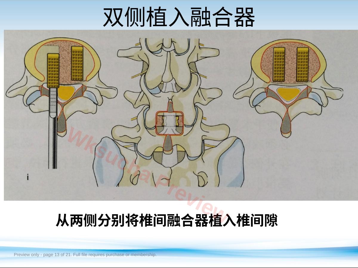 预览第 13 页