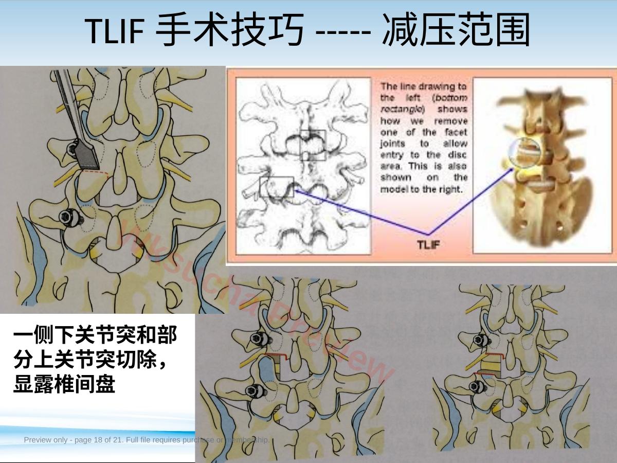 预览第 18 页