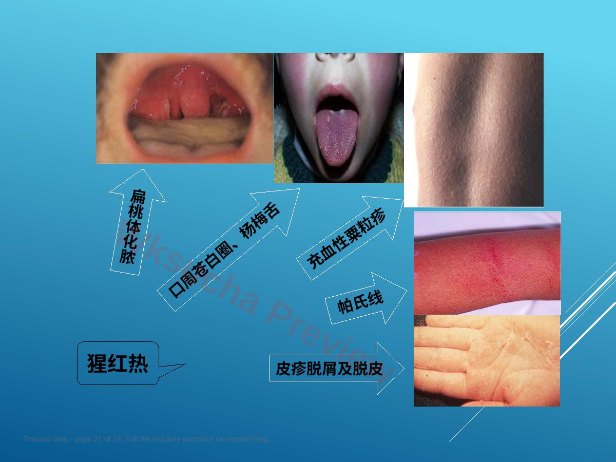 预览第 21 页