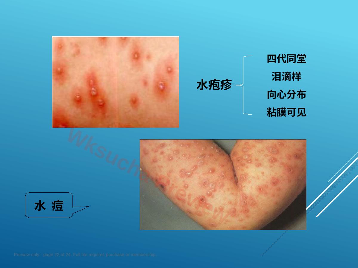 预览第 22 页