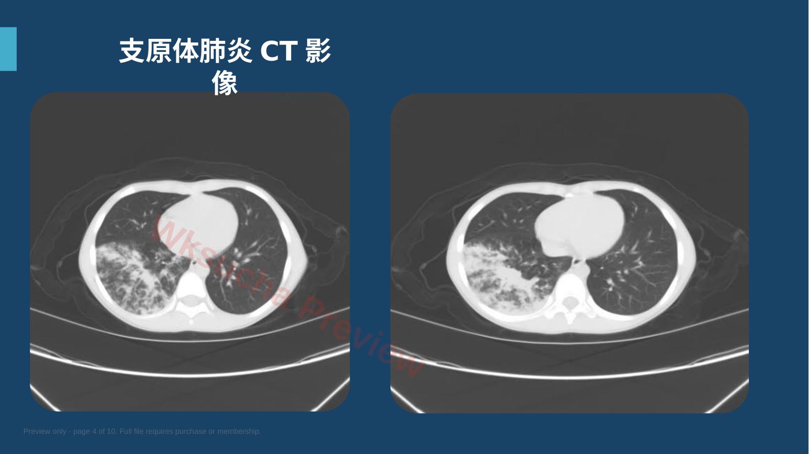 预览第 4 页