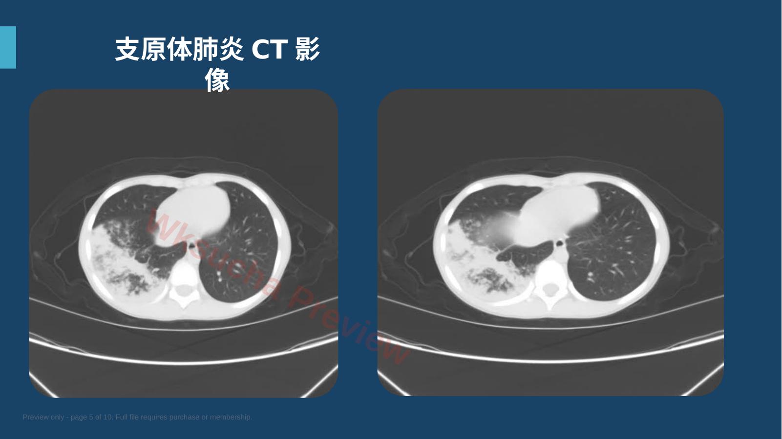预览第 5 页