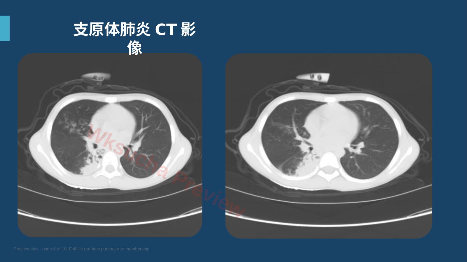 预览第 6 页