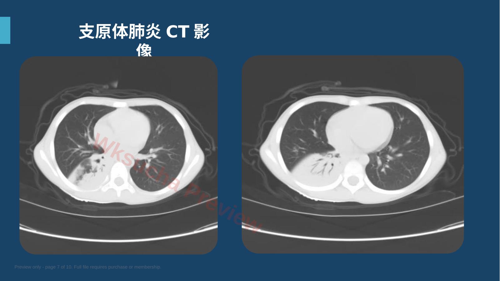 预览第 7 页