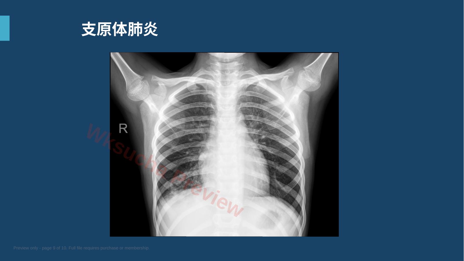 预览第 9 页