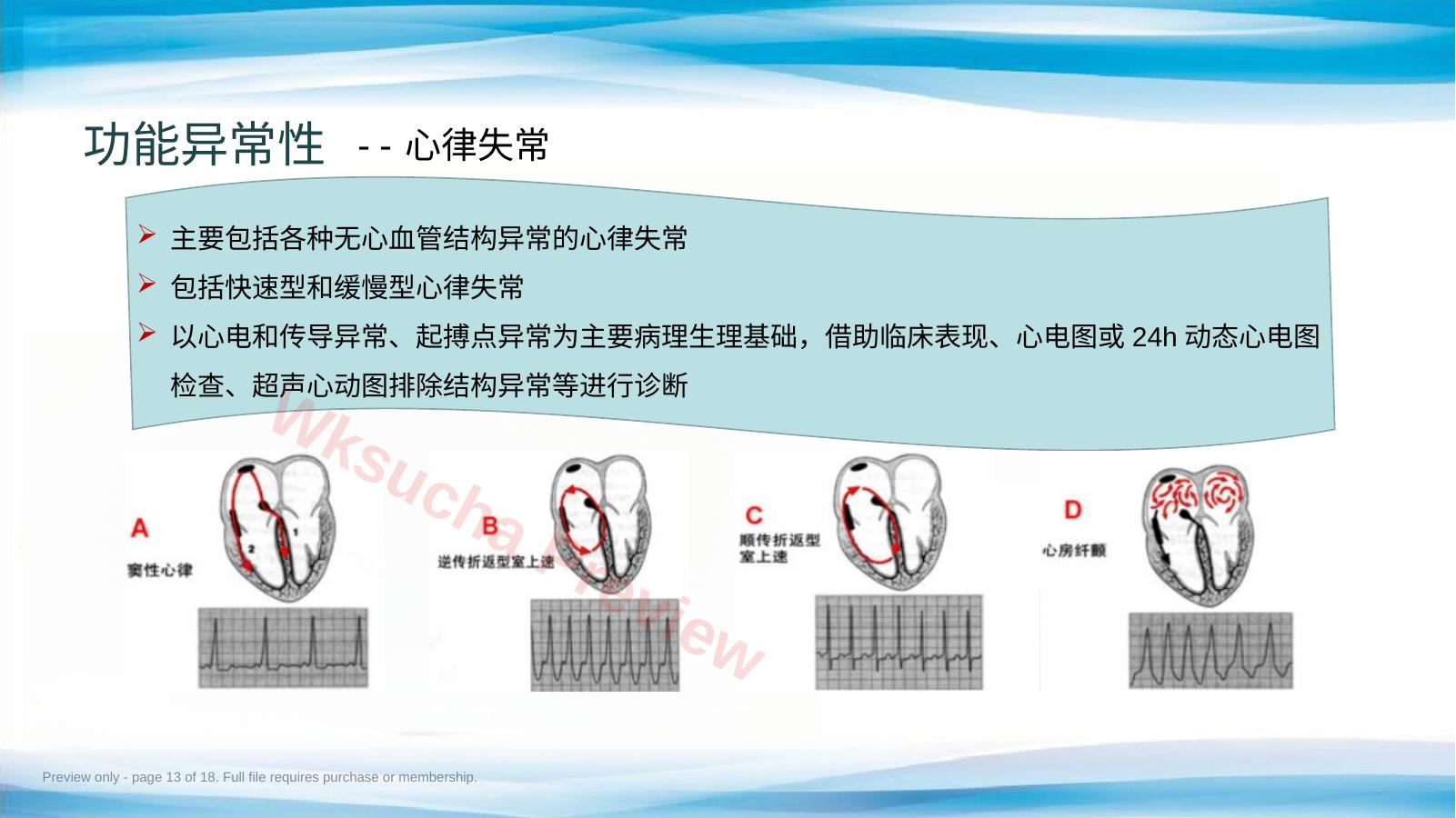 预览第 13 页