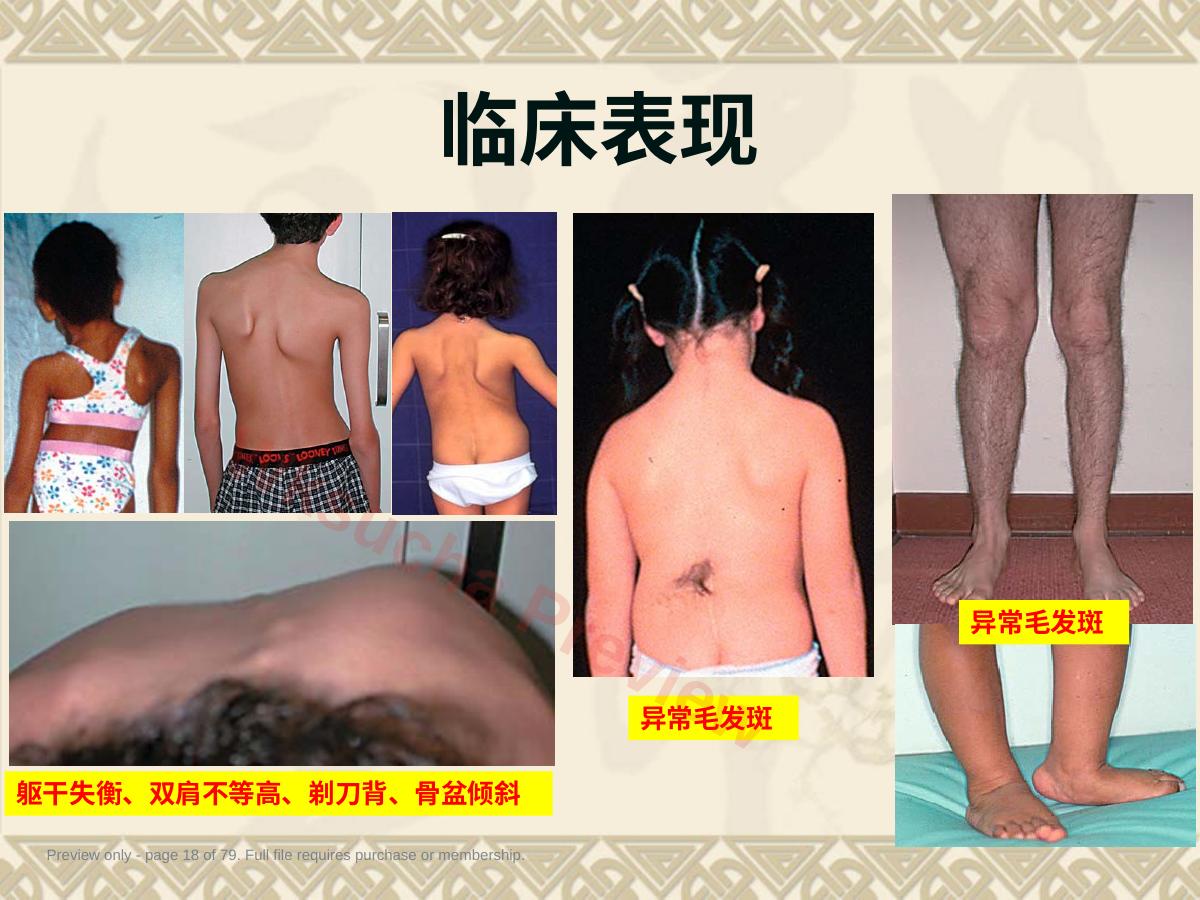 预览第 18 页