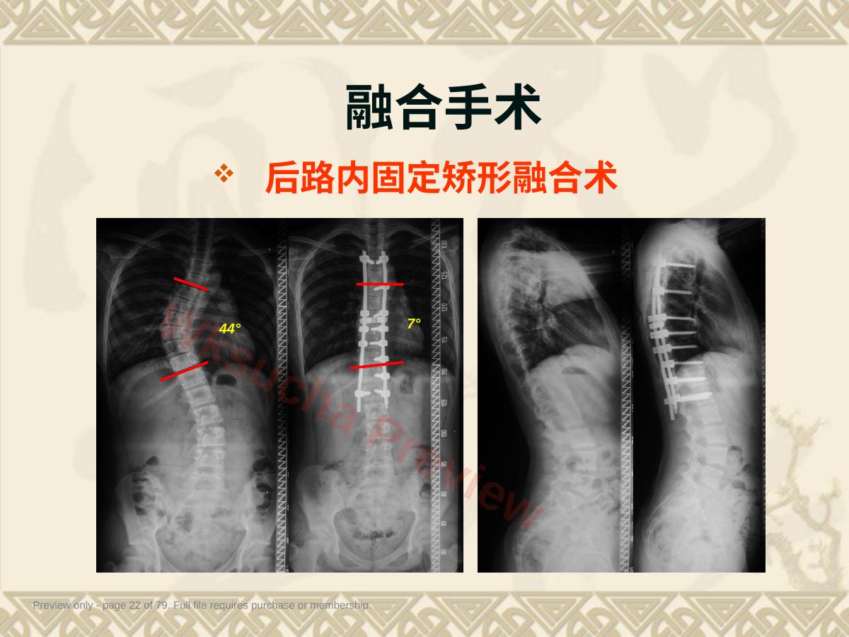 预览第 22 页