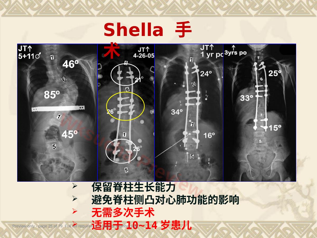 预览第 25 页
