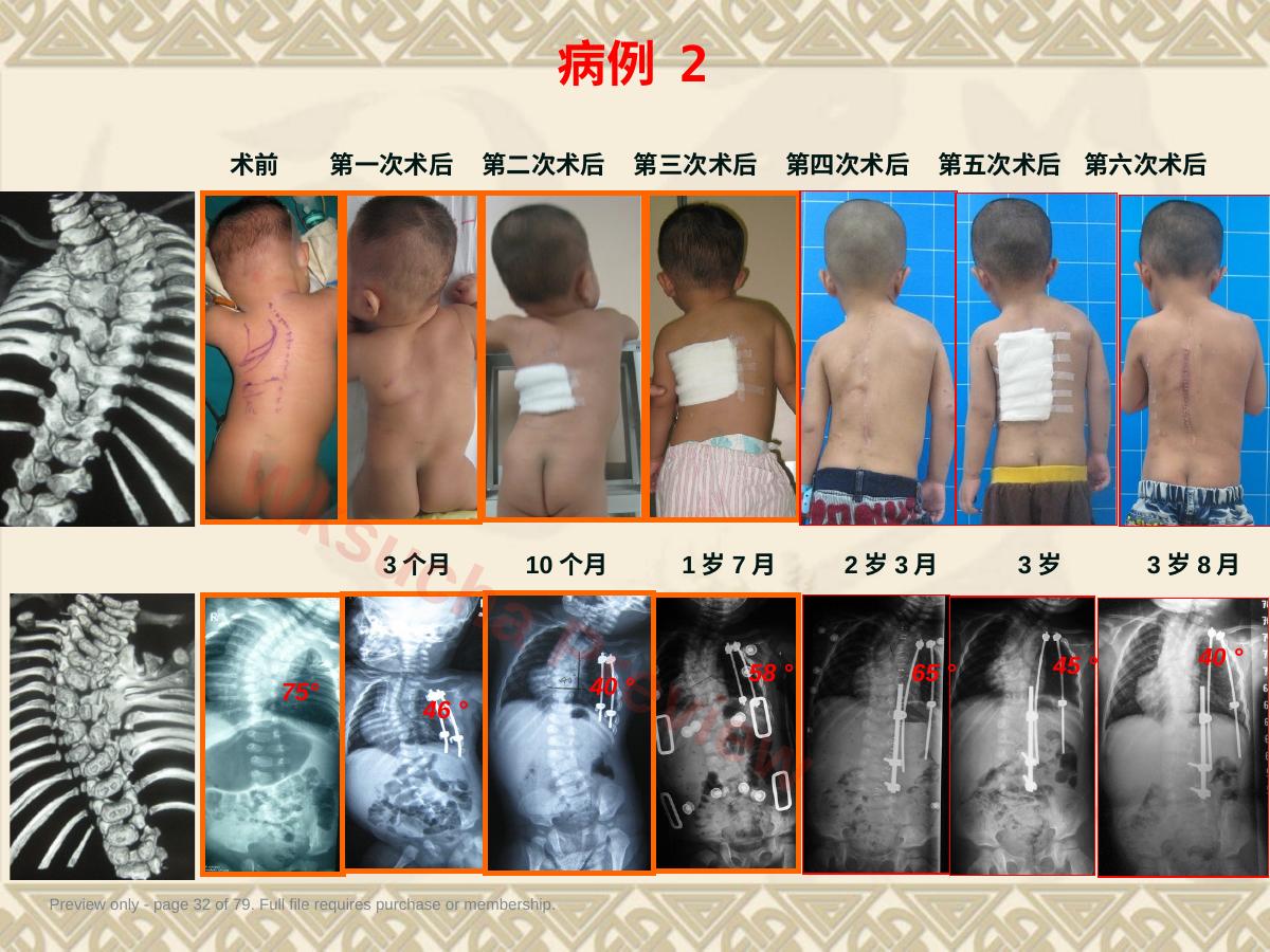预览第 32 页