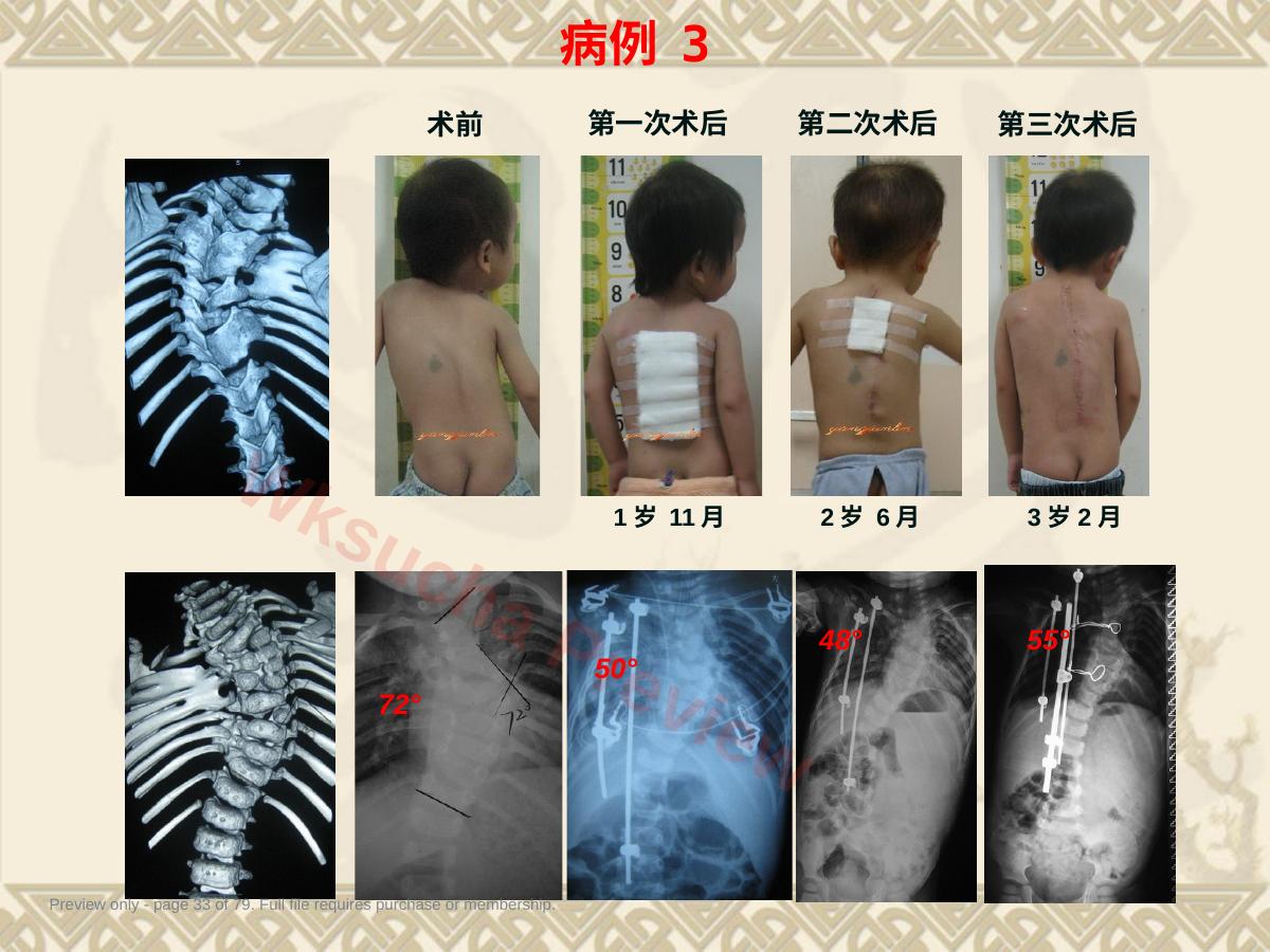 预览第 33 页