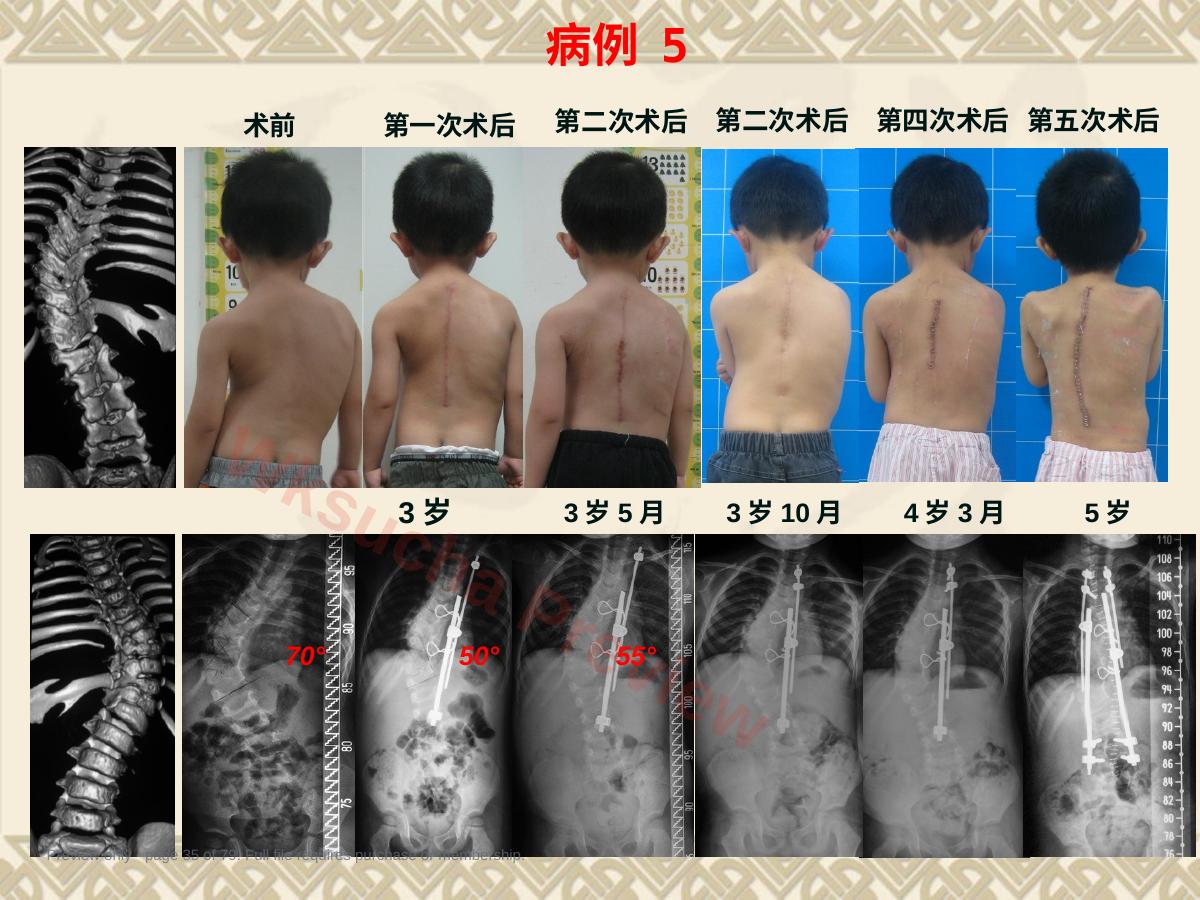 预览第 35 页