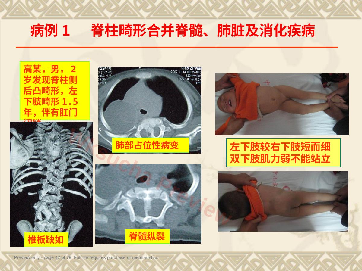 预览第 42 页