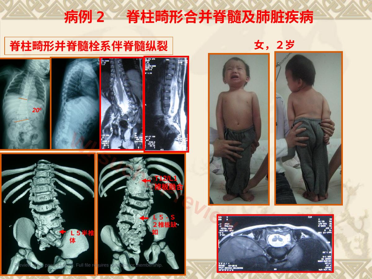 预览第 44 页