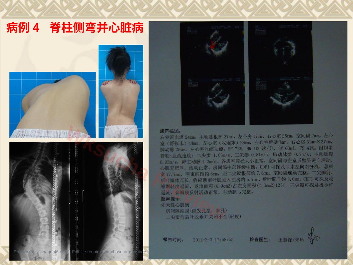 预览第 46 页