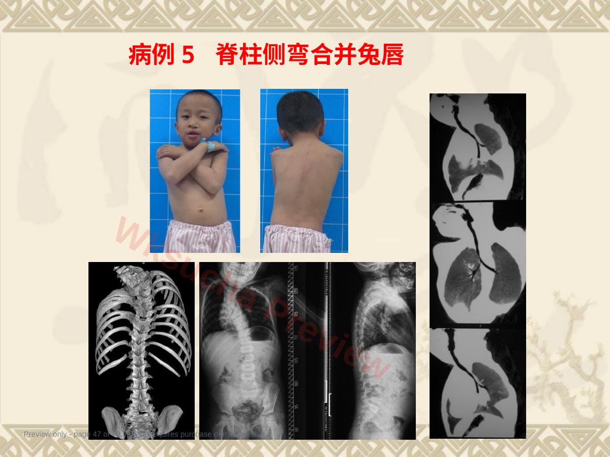 预览第 47 页