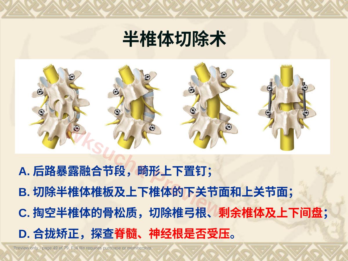 预览第 49 页