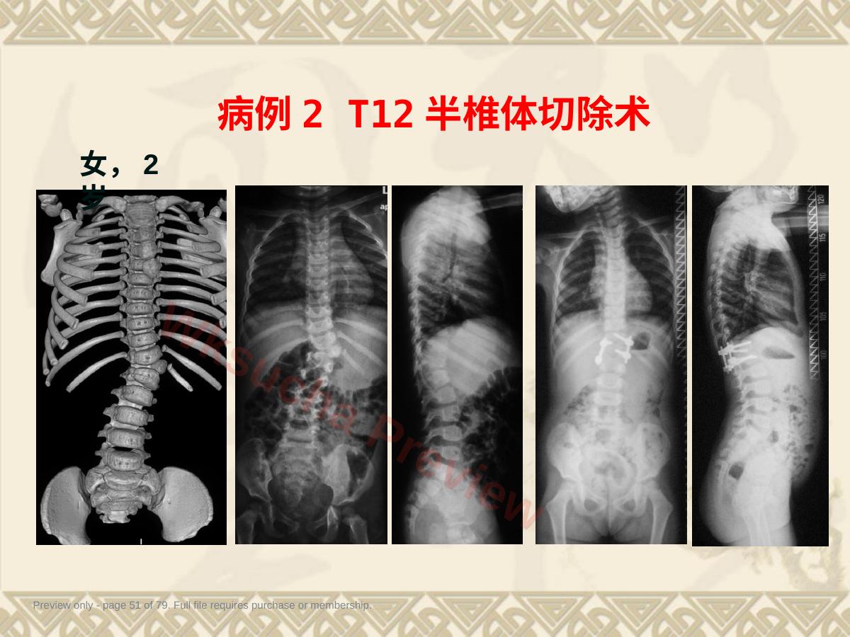 预览第 51 页
