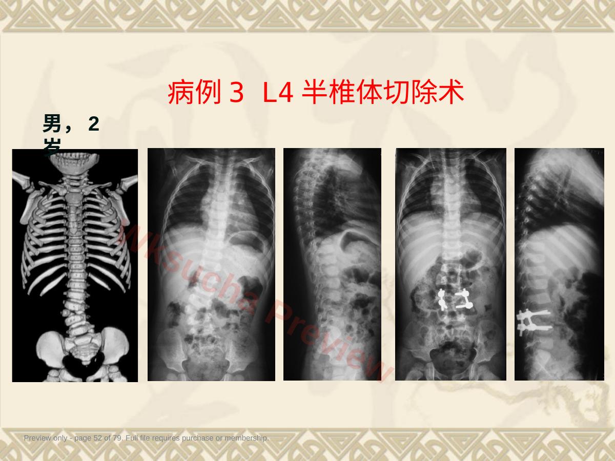 预览第 52 页