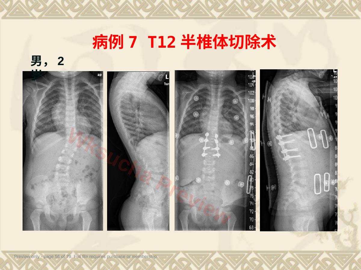 预览第 56 页