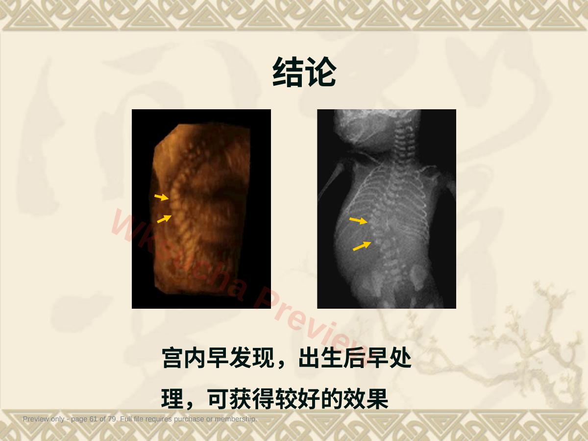 预览第 61 页