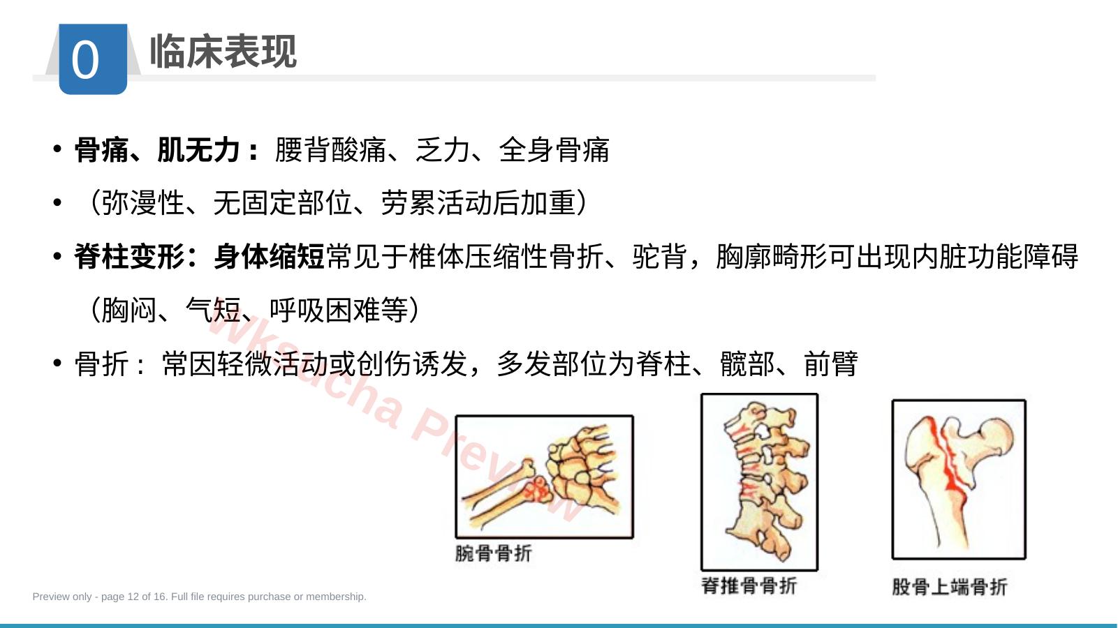 预览第 12 页