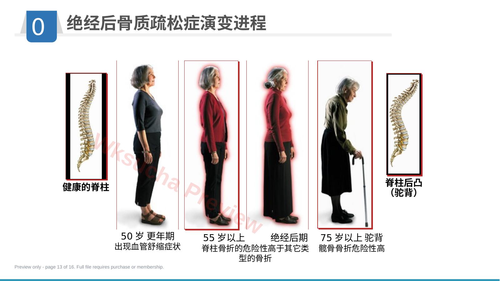 预览第 13 页