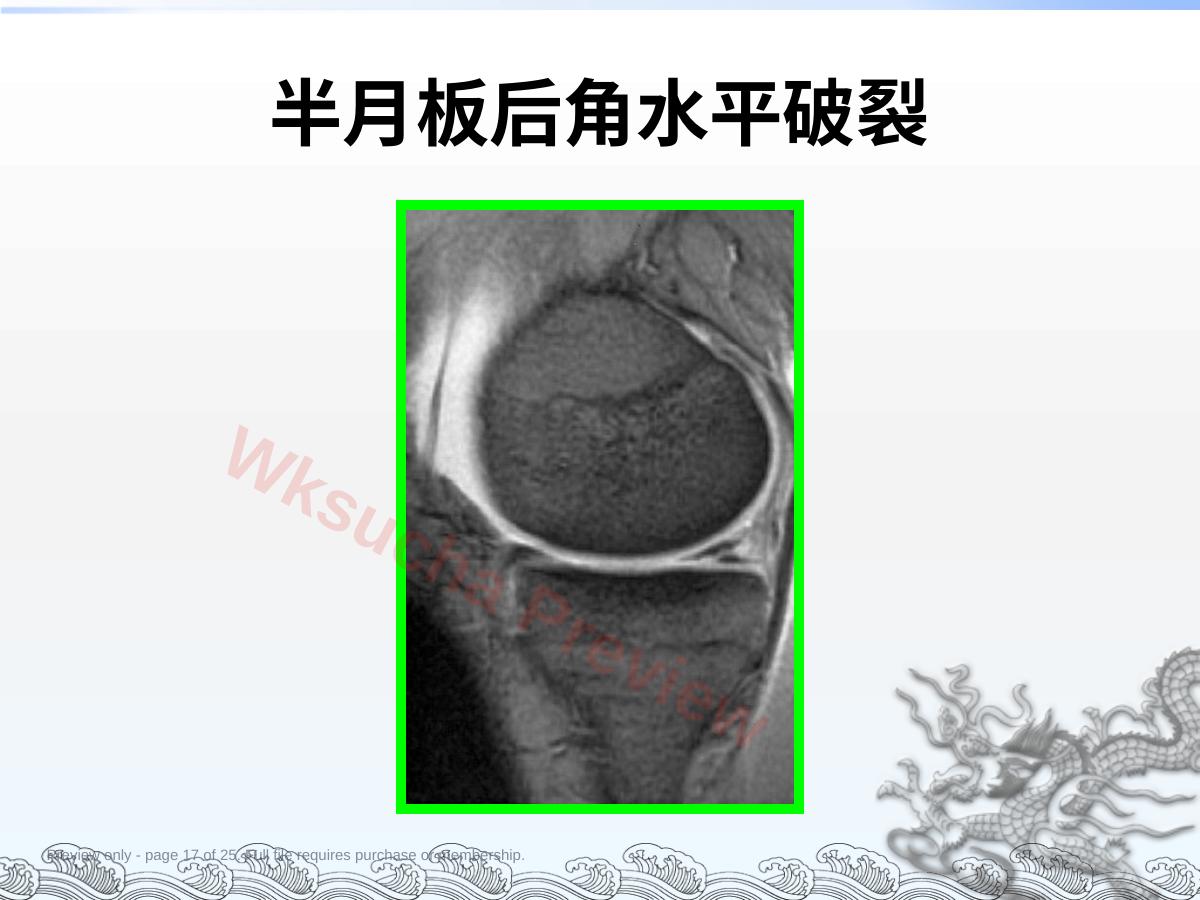 预览第 17 页