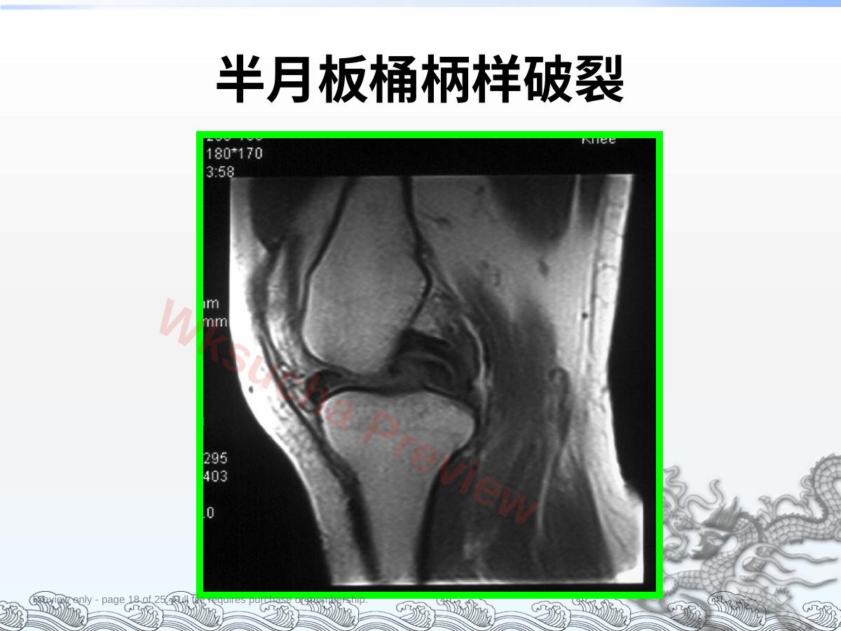 预览第 18 页