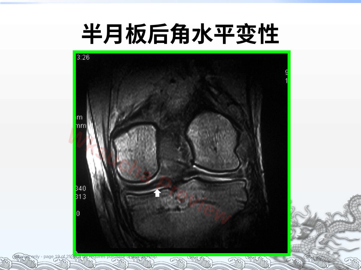预览第 19 页