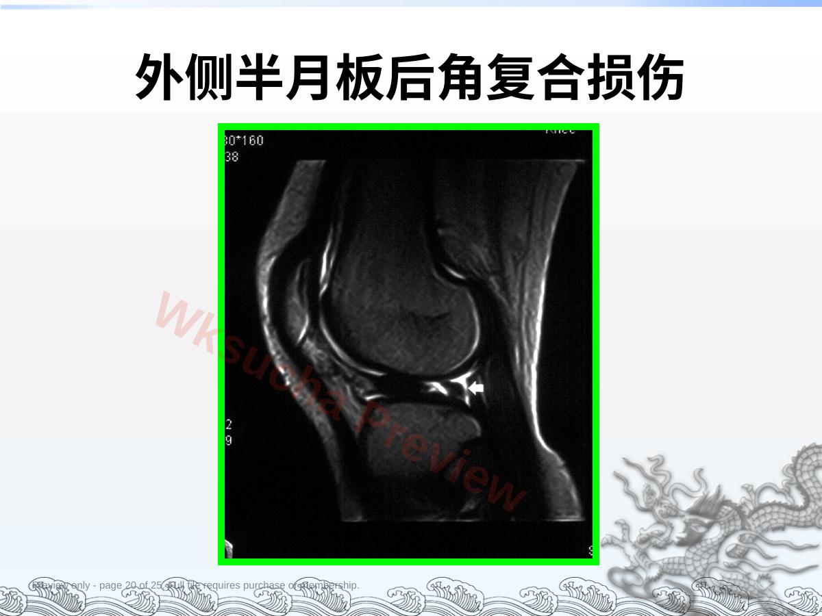 预览第 20 页