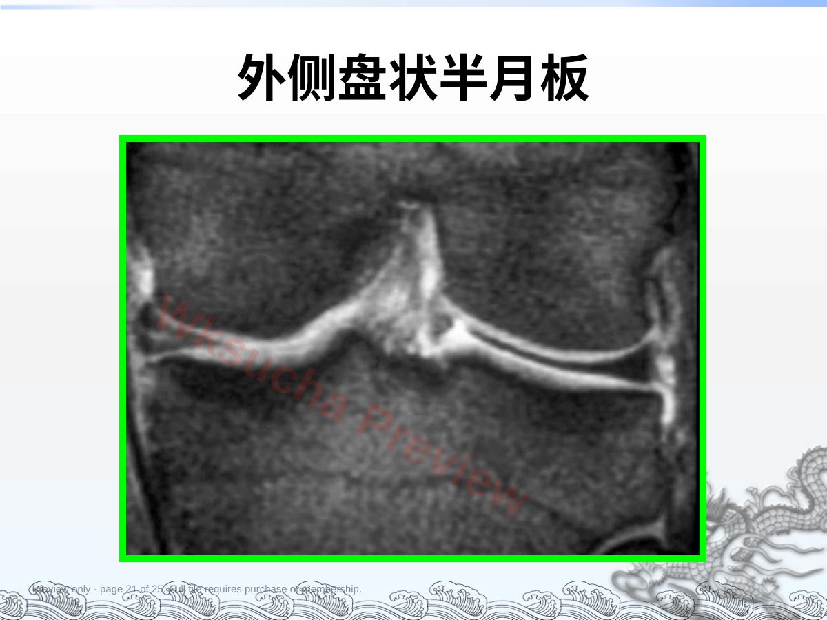 预览第 21 页