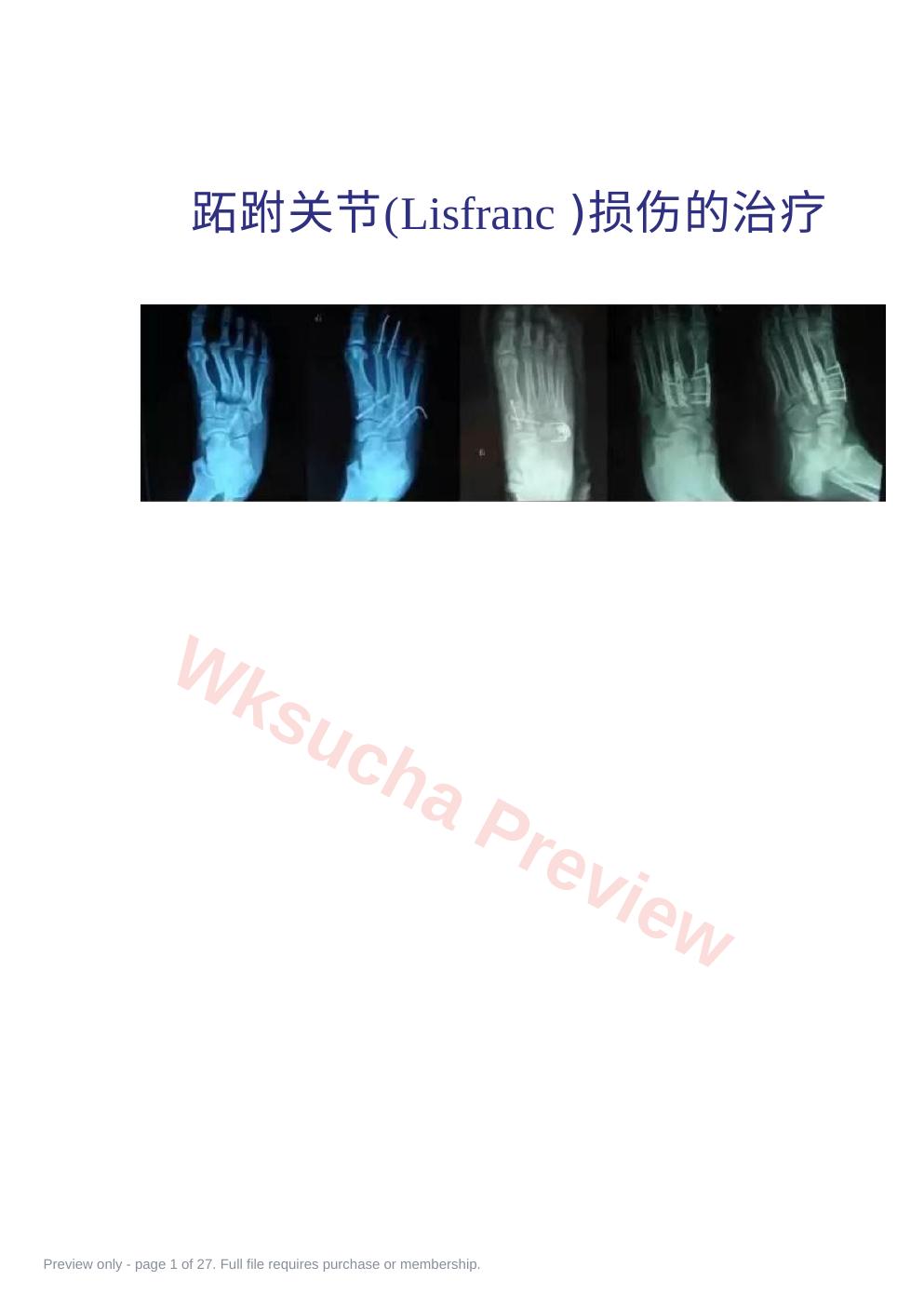 跖跗关节(Lisfranc)损伤的治疗
