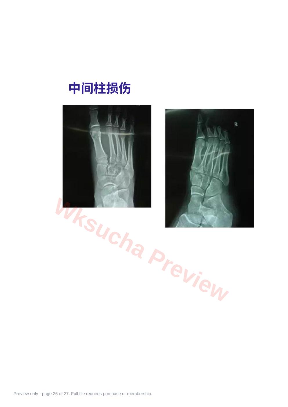 预览第 25 页